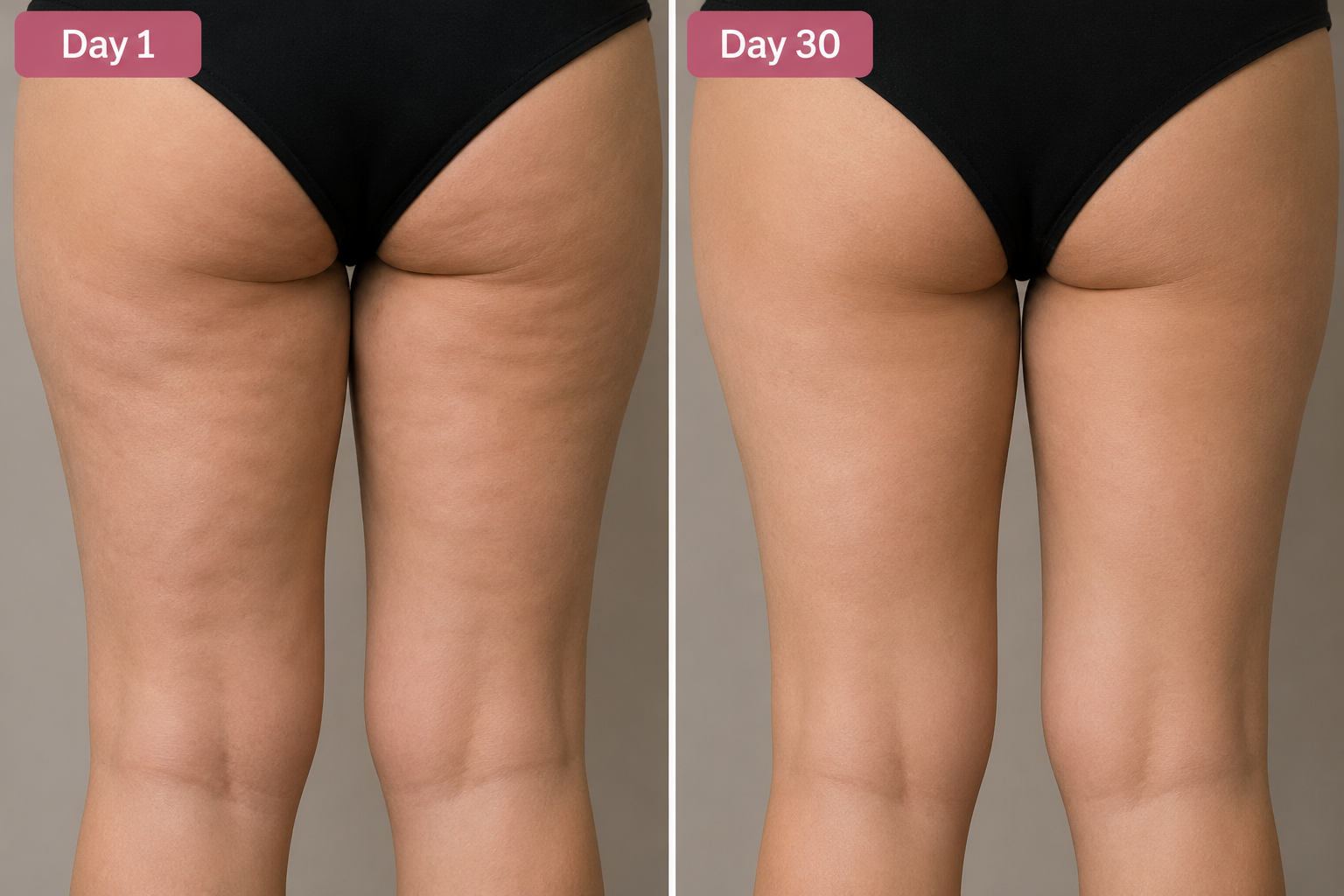 Cellulite Removal Cream